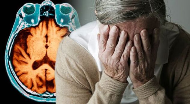 Studimi i ri: Një e treta e rasteve të demencës lidhen me sëmundje jashtë trurit