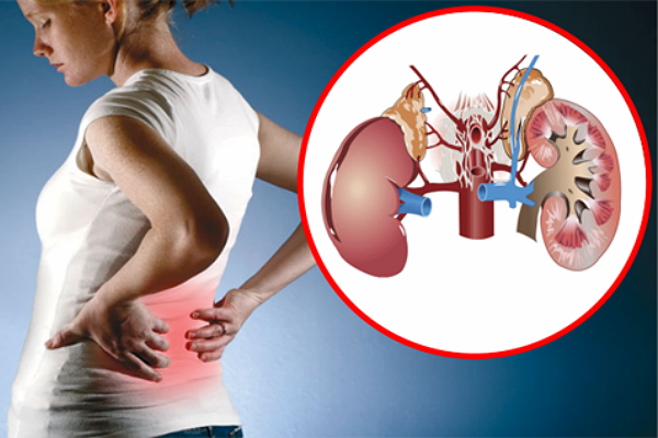 Sëmundjet e veshkave, rrezik në rritje për shëndetin global