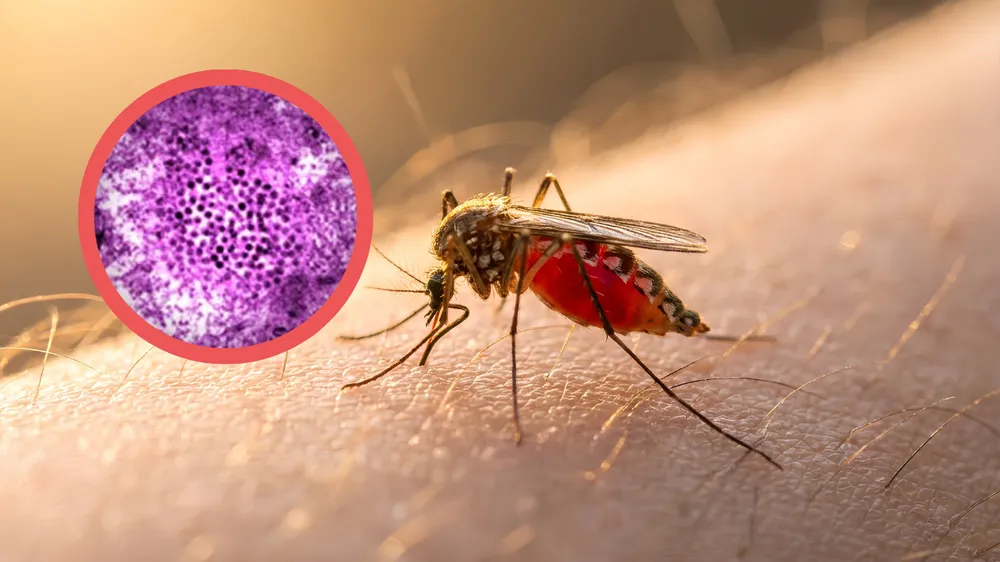 Studimi zbulon se një sëmundje tropikale torturuese rrezikon në Evropën